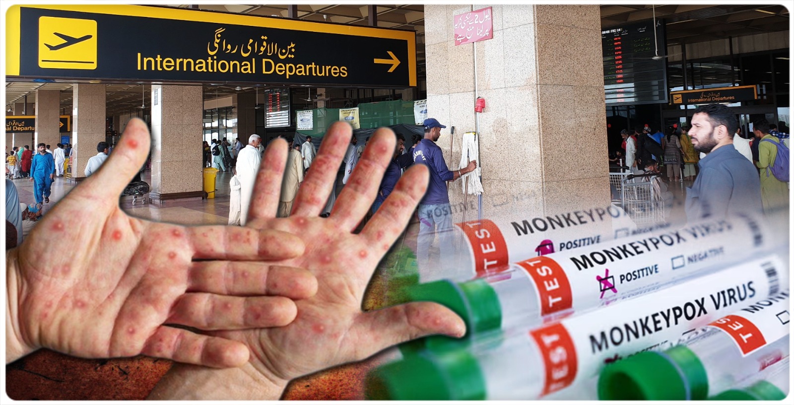 three-people-infected-with-monkeypox-at-karachi-airport-in-pakistan