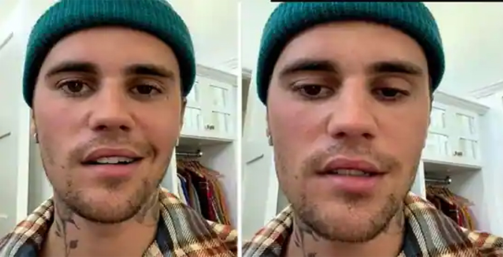 half-of-justin-beibers-face-paralysed-by-serious-virus-cancels-shows