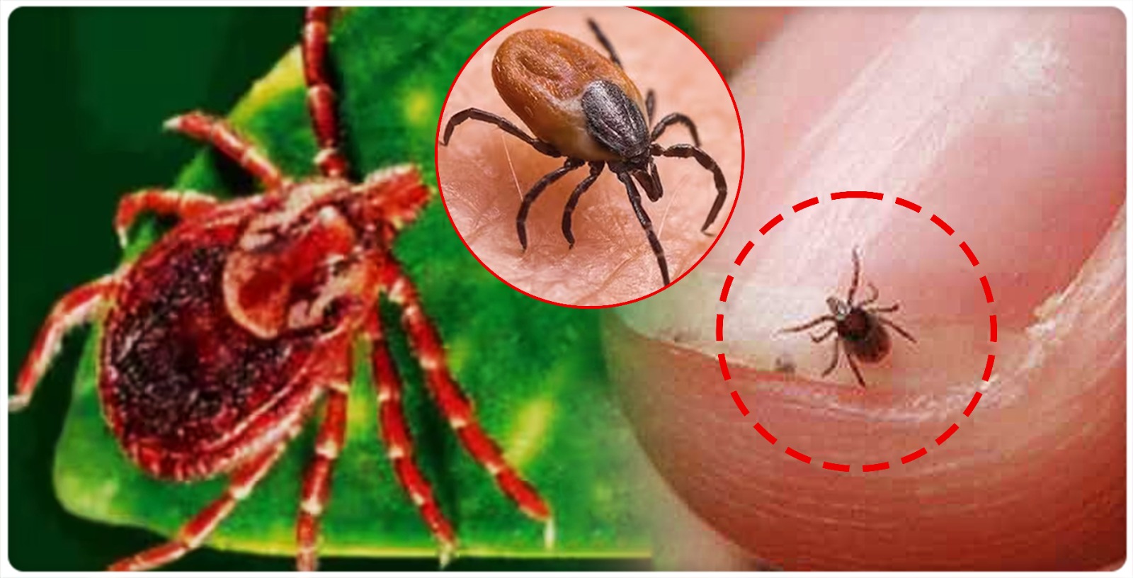total-14-death-cases-registered-due-to-scrub-typhus-infection-in-india