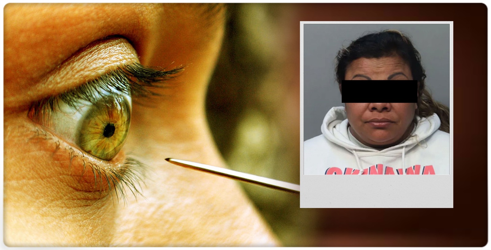 US Woman Stabs Boyfriend in Eye with Needle for Looking At Other Women