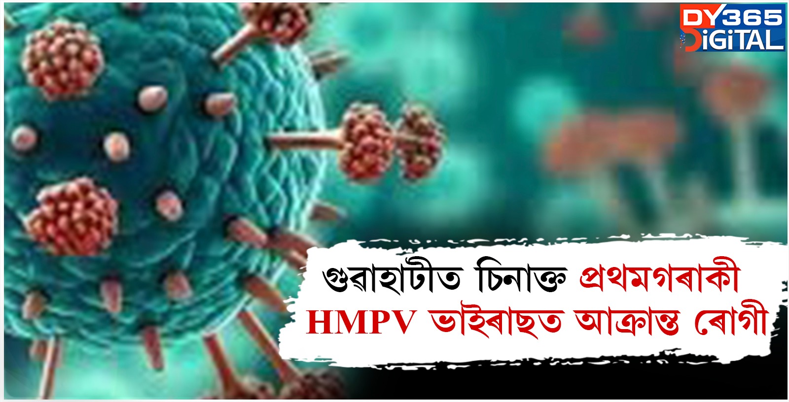 গুৱাহাটীত চিনাক্ত প্ৰথমগৰাকী HMPV ভাইৰাছত আক্ৰান্ত ৰোগী