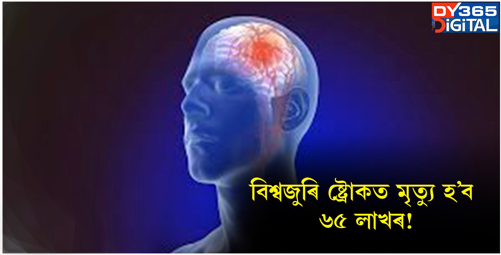  বিশ্বজুৰি ষ্ট্ৰোকত মৃত্যু হ’ব ৬৫ লাখৰ!